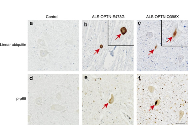 Immunohistochemistry using NFkB P-p65